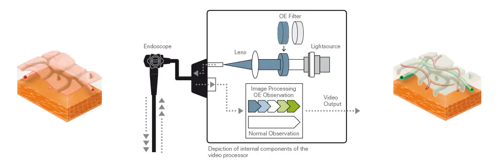 OE-Imaging