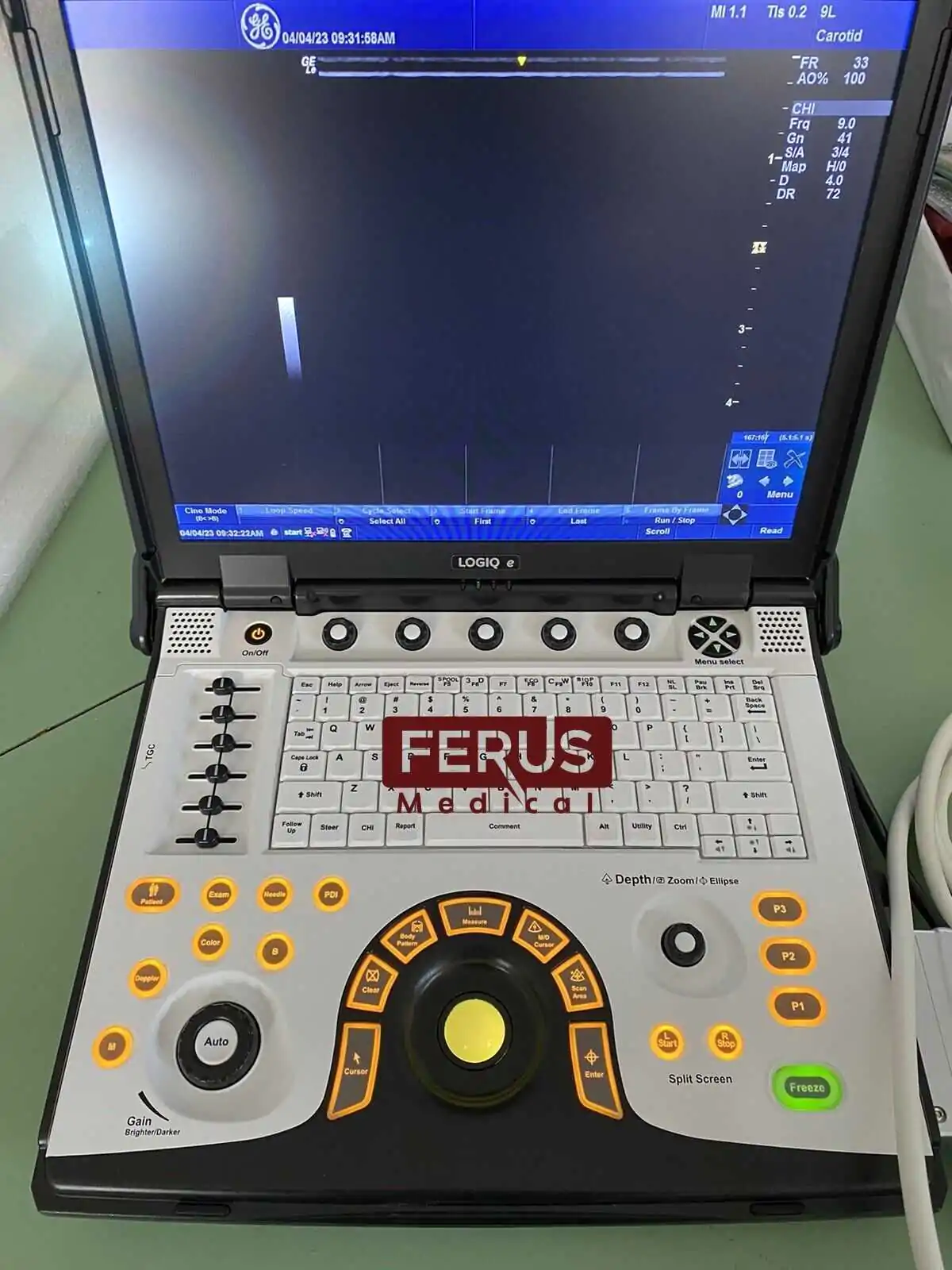 GE Logiq e Nextgen R7 Ultrasound System - Image 7