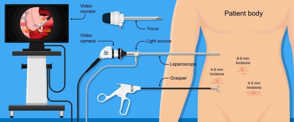 What is Video Endoscopy Equipment